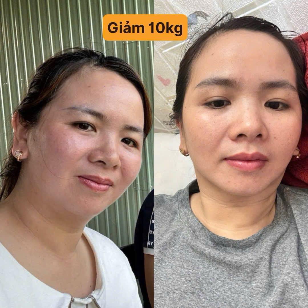 Giảm 10kg sau khi dùng đạm